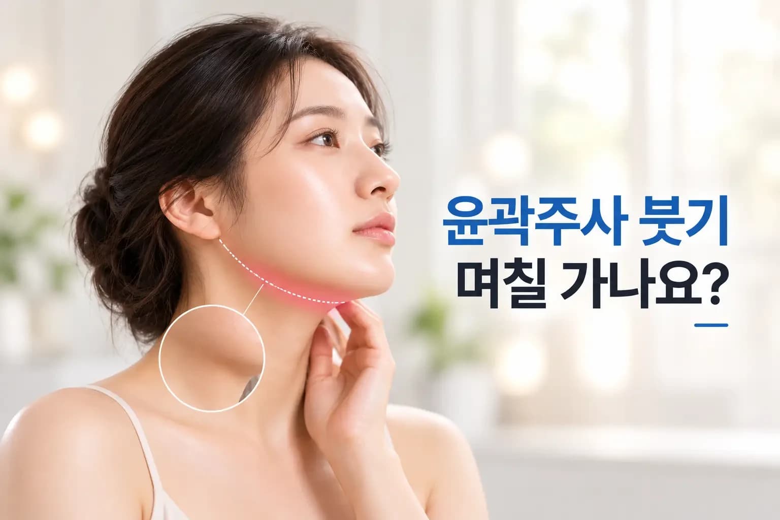 턱밑과 턱선 부위를 점선으로 짚은 옆모습 크롭 사진으로 윤곽주사 붓기 기간을 다룬 썸네일