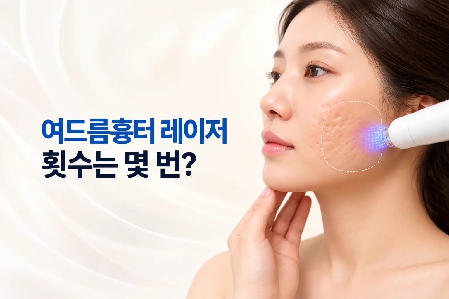 프랙셔널 레이저 빛이 패인 흉터 진피에 닿아 콜라겐이 차오르는 여드름흉터 레이저 횟수 썸네일